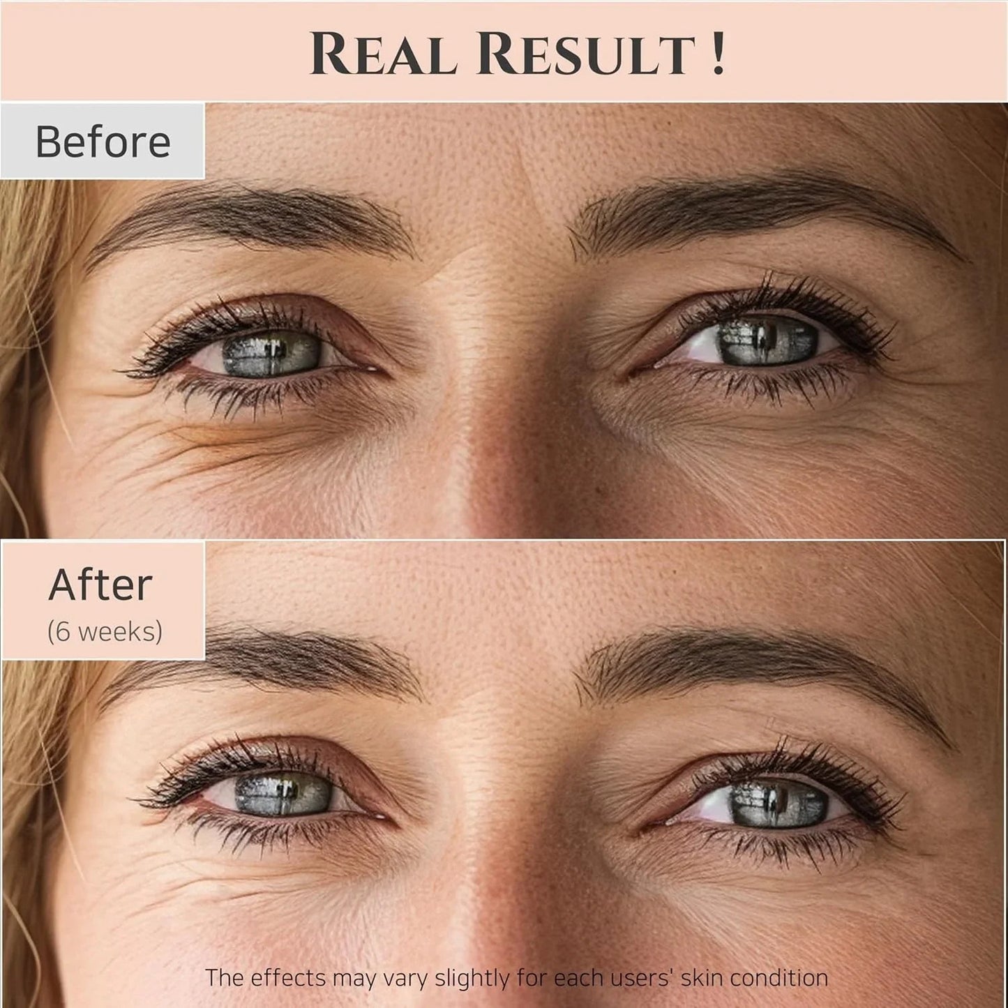 Joseon Revive Eye Serum with Retinal & Niacinamide for Puffy Eyes, Wrinkles, Dark Circles